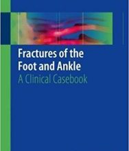 free-pdf-download-Fractures of the Foot and Ankle: A Clinical Casebook 1st ed. 2018 Edition