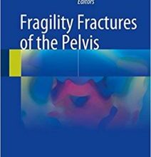 free-pdf-download-Fragility Fractures of the Pelvis 1st ed