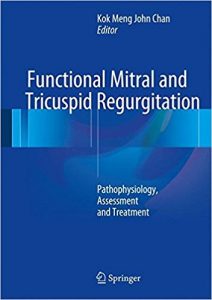 free-pdf-download-Functional Mitral and Tricuspid Regurgitation: Pathophysiology