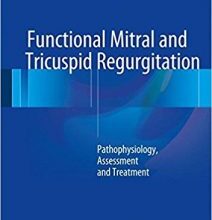 free-pdf-download-Functional Mitral and Tricuspid Regurgitation: Pathophysiology