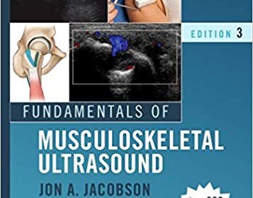 free-pdf-download-Fundamentals of Musculoskeletal Ultrasound 3rd Edition