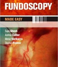 free-pdf-download-Fundoscopy Made Easy