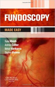 free-pdf-download-Fundoscopy Made Easy