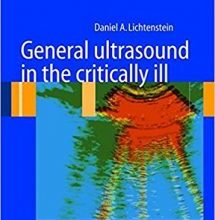 free-pdf-download-General ultrasound in the critically ill