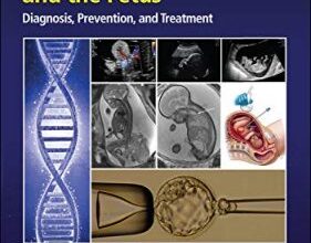 free-pdf-download-Genetic Disorders and the Fetus 8th Edition