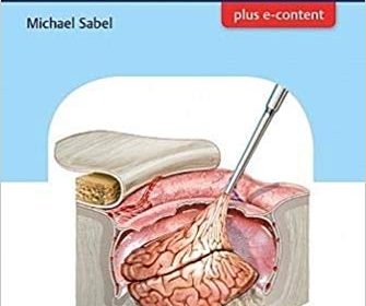 free-pdf-download-Getting Ready for Brain Tumor Surgery 1st Edition