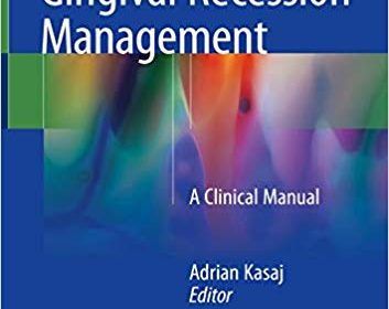 free-pdf-download-Gingival Recession Management: A Clinical Manual 1st ed. 2018 Edition