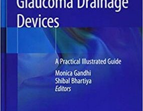 free-pdf-download-Glaucoma Drainage Devices: A Practical Illustrated Guide