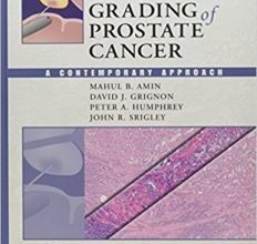 free-pdf-download-Gleason Grading of Prostate Cancer: A Contemporary Approach 1st Edition