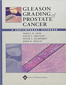 free-pdf-download-Gleason Grading of Prostate Cancer: A Contemporary Approach 1st Edition