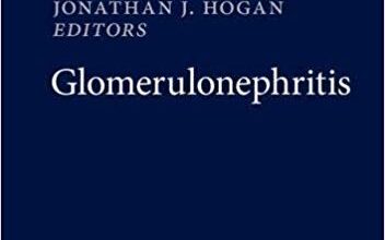 free-pdf-download-Glomerulonephritis 1st Edition