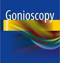 free-pdf-download-Gonioscopy