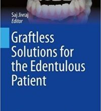 free-pdf-download-Graftless Solutions for the Edentulous Patient (BDJ Clinician’s Guides) 1st ed. 2018 Edition