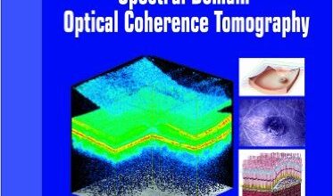 free-pdf-download-Guide to Interpreting Spectral Domain Optical Coherence Tomography 2nd Revised ed. Edition