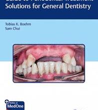 free-pdf-download-Guide to Periodontal Treatment Solutions for General Dentistry