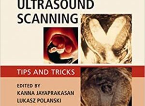 free-pdf-download-Gynaecological Ultrasound Scanning: Tips and Tricks 1st Edition