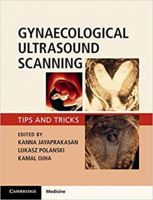 free-pdf-download-Gynaecological Ultrasound Scanning: Tips and Tricks 1st Edition