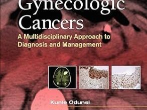 free-pdf-download-Gynecologic Cancers: A Multidisciplinary Approach to Diagnosis and Management (Current Multidisciplinary Oncology) 1st Edition