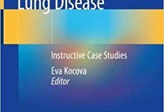 free-pdf-download-HRCT in Interstitial Lung Disease: Instructive Case Studies 1st ed