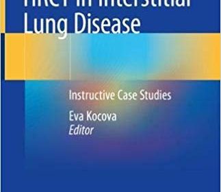 free-pdf-download-HRCT in Interstitial Lung Disease: Instructive Case Studies 1st ed