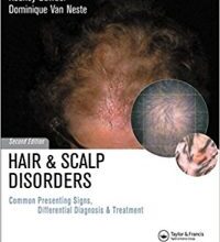 free-pdf-download-Hair and Scalp Disorders: Common Presenting Signs