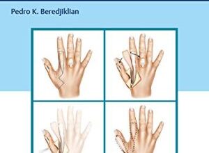 free-pdf-download-Hand Surgery: Tricks of the Trade