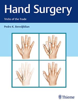 free-pdf-download-Hand Surgery: Tricks of the Trade