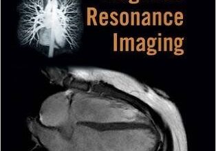 free-pdf-download-Handbook of Cardiovascular Magnetic Resonance Imaging 1st Edition