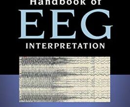 free-pdf-download-Handbook of EEG Interpretation