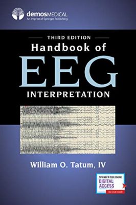 free-pdf-download-Handbook of EEG Interpretation