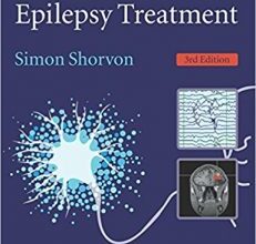 free-pdf-download-Handbook of Epilepsy Treatment 3rd Edition