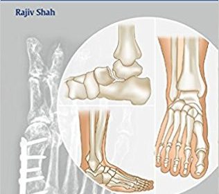 free-pdf-download-Handbook of Foot and Ankle Orthopedics 1st Edition