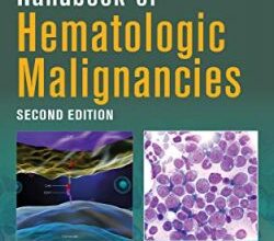 free-pdf-download-Handbook of Hematologic Malignancies 2nd Edition