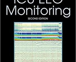 free-pdf-download-Handbook of ICU EEG Monitoring