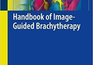 free-pdf-download-Handbook of Image-Guided Brachytherapy 1st ed. 2017 Edition