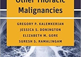 free-pdf-download-Handbook of Lung Cancer and Other Thoracic Malignancies 1st Edition