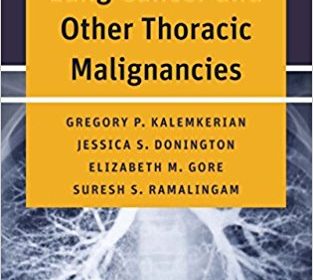 free-pdf-download-Handbook of Lung Cancer and Other Thoracic Malignancies 1st Edition