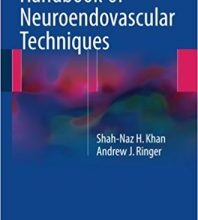 free-pdf-download-Handbook of Neuroendovascular Techniques 1st ed