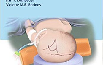 free-pdf-download-Handbook of Pediatric Neurosurgery 1st Edition