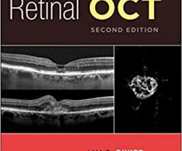 free-pdf-download-Handbook of Retinal OCT: Optical Coherence Tomography 2nd Edition