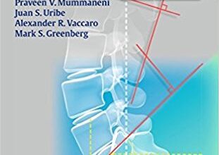 free-pdf-download-Handbook of Spine Surgery 2nd Edition