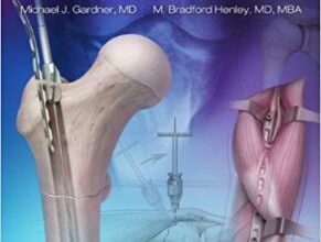 free-pdf-download-Harborview Illustrated Tips and Tricks in Fracture Surgery