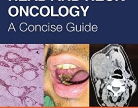 free-pdf-download-Head and Neck Oncology: A Concise Guide