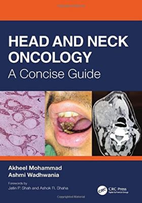 free-pdf-download-Head and Neck Oncology: A Concise Guide