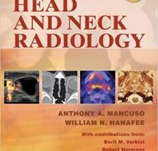 free-pdf-download-Head and Neck Radiology (2 Volumes) 1 Har/Psc Edition