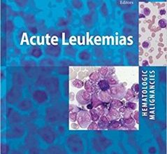 free-pdf-download-Hematologic Malignancies: Acute Leukemias