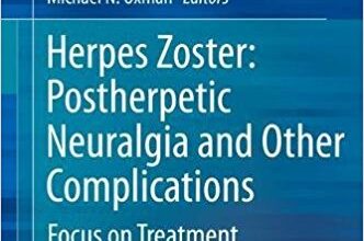 free-pdf-download-Herpes Zoster: Postherpetic Neuralgia and Other Complications: Focus on Treatment and Prevention 1st ed. 2017 Edition