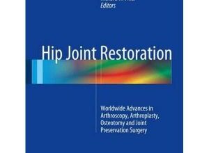 free-pdf-download-Hip Joint Restoration: Worldwide Advances in Arthroscopy