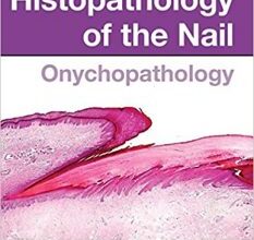 free-pdf-download-Histopathology of the Nail: Onychopathology 1st Edition