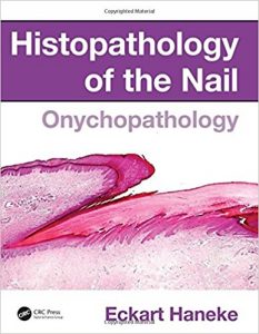 free-pdf-download-Histopathology of the Nail: Onychopathology 1st Edition